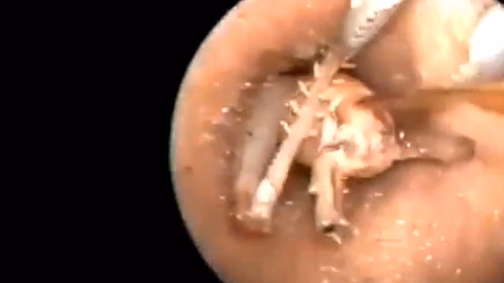 Wie kann man Aggressionsverhalten beobachten?