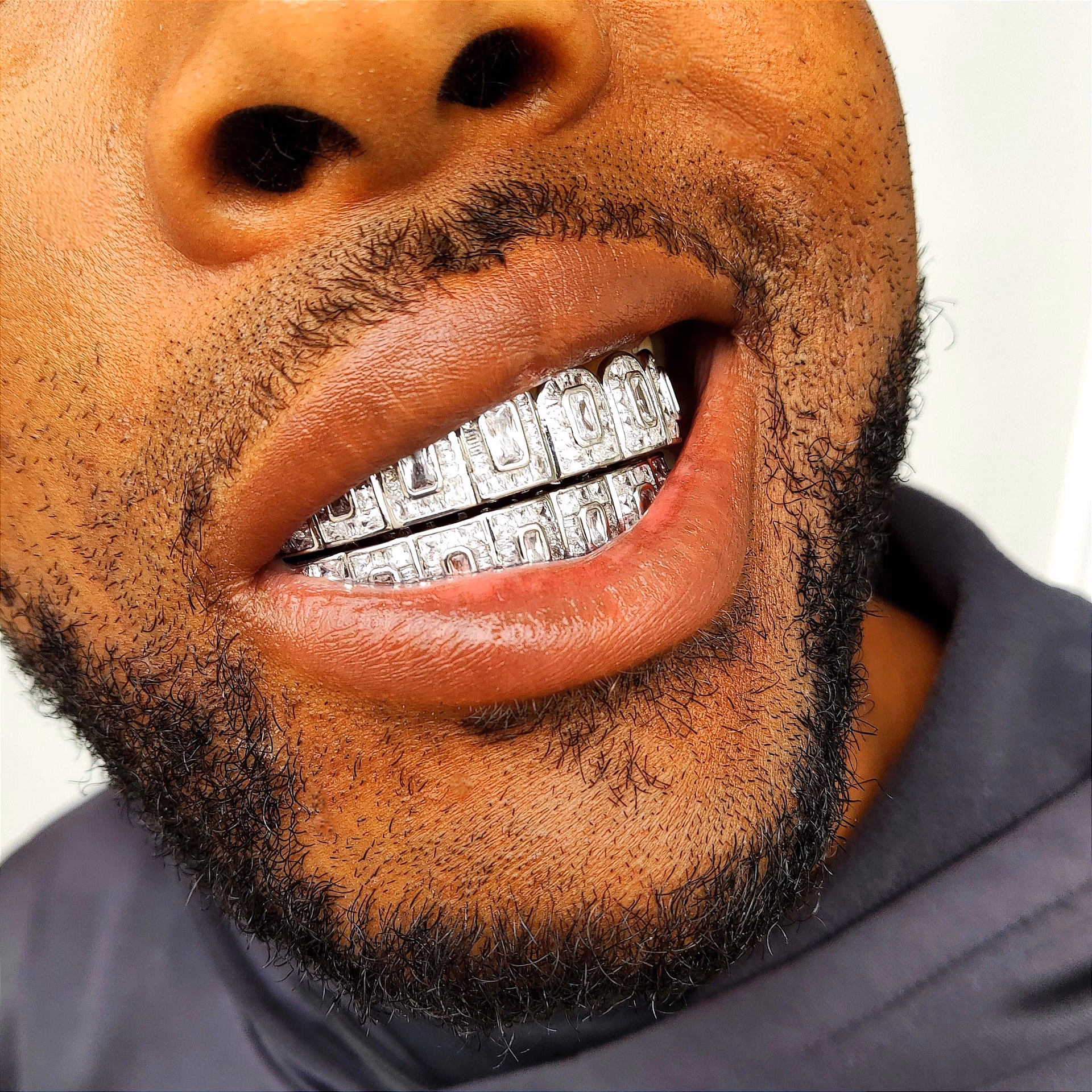Where can I buy custom-made gold Grillz teeth?