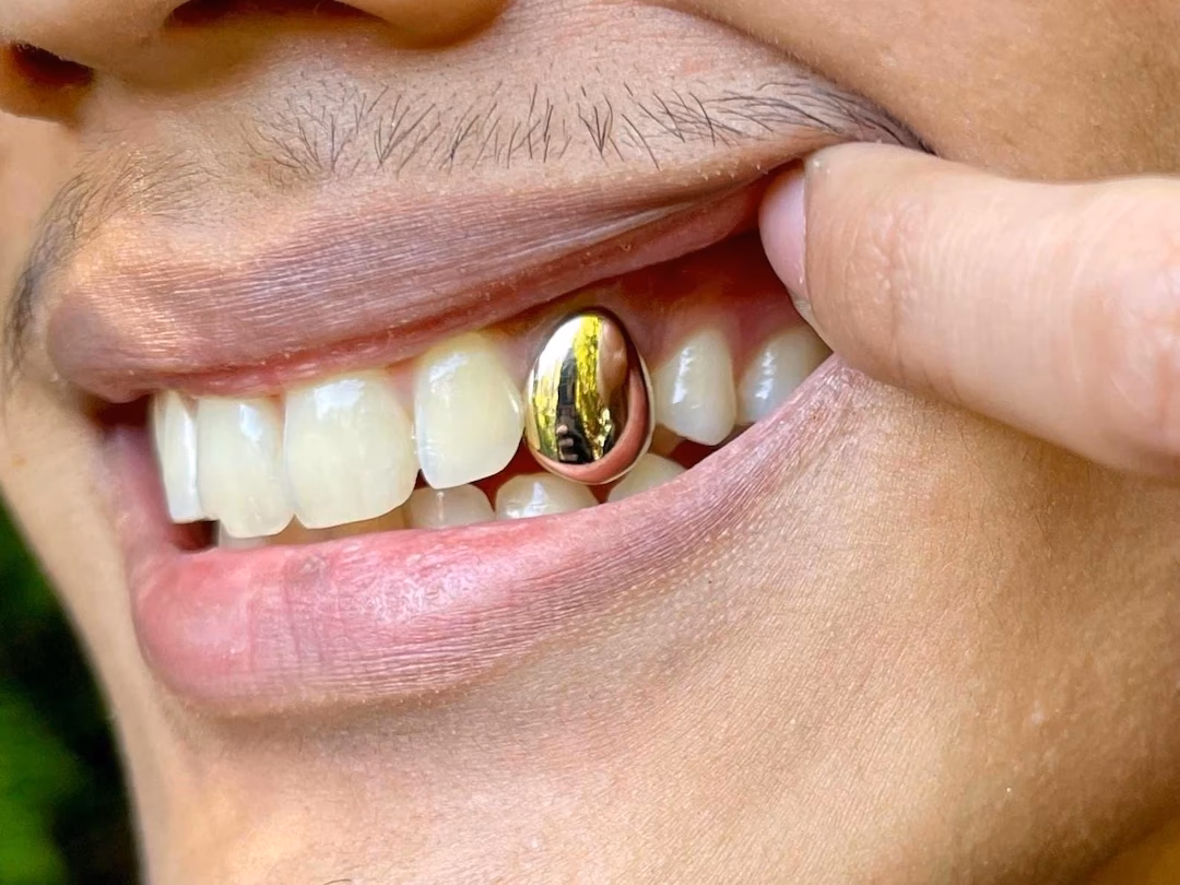 Was ist der Unterschied zwischen echtem und goldenem Grillz?