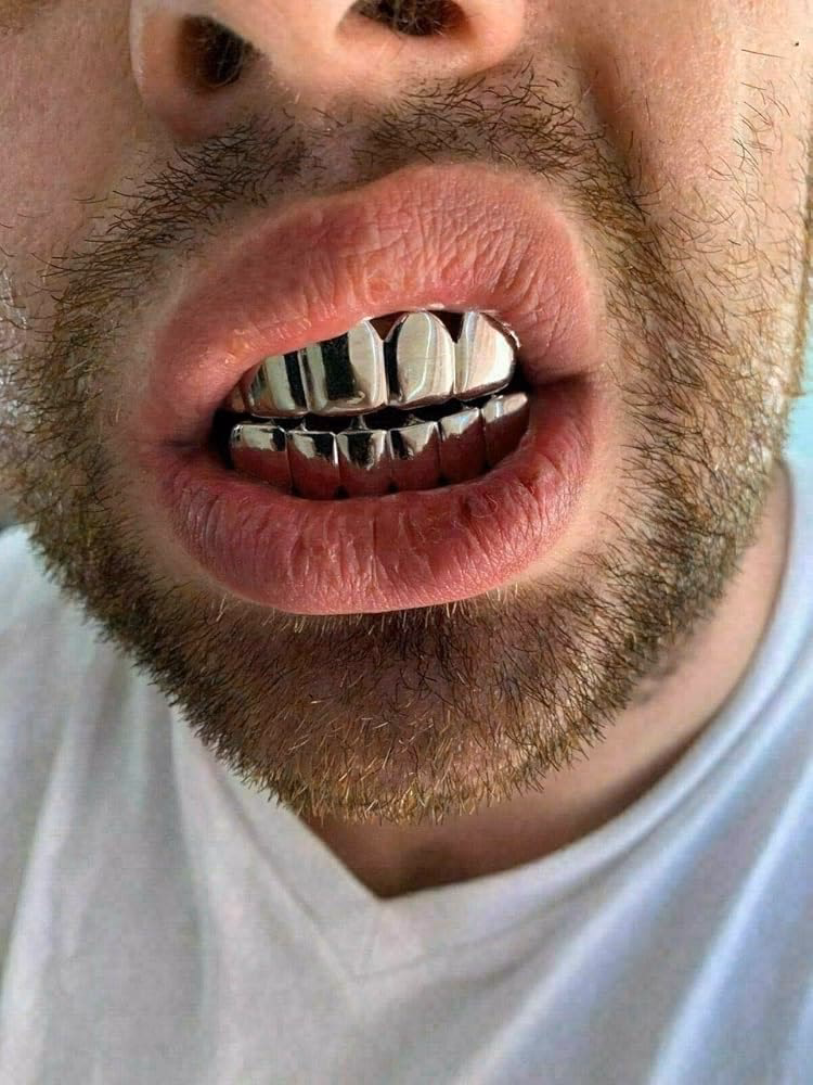 Are silver teeth better than gold Grillz?
